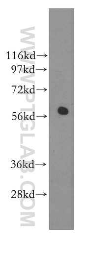 [11364-1-AP-150UL] RAD23A Polyclonal antibody
