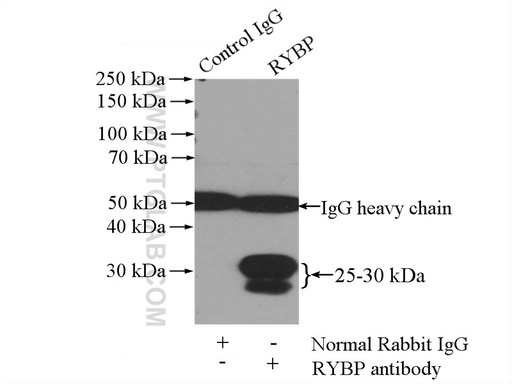 [11365-1-AP-150UL] RYBP Polyclonal antibody