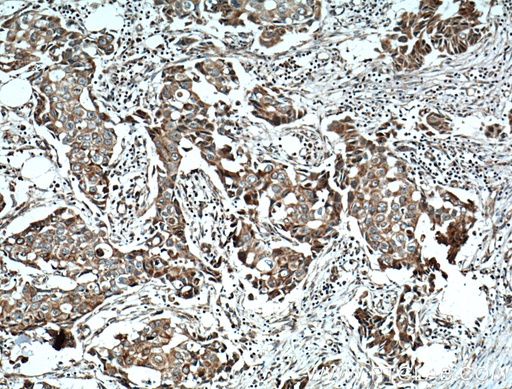 [11367-1-AP-150UL] NCKIPSD Polyclonal antibody