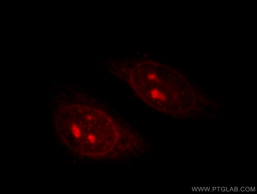 [11368-1-AP-20UL] TIN2 Polyclonal antibody