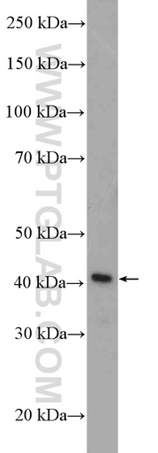[11370-1-AP-20UL] SEPT1 Polyclonal antibody