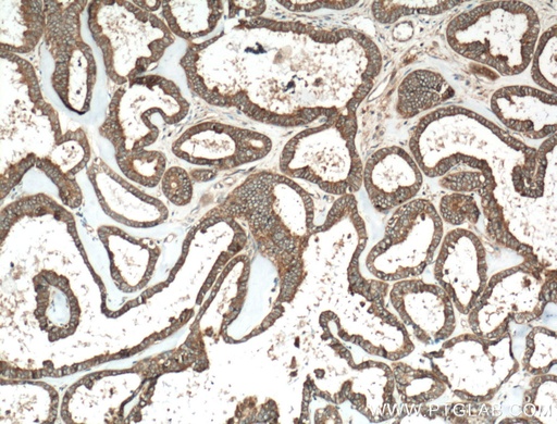 [11371-1-AP-150UL] HPS6 Polyclonal antibody