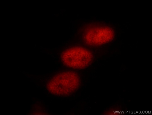 [11372-1-AP-20UL] TLE3 Polyclonal antibody