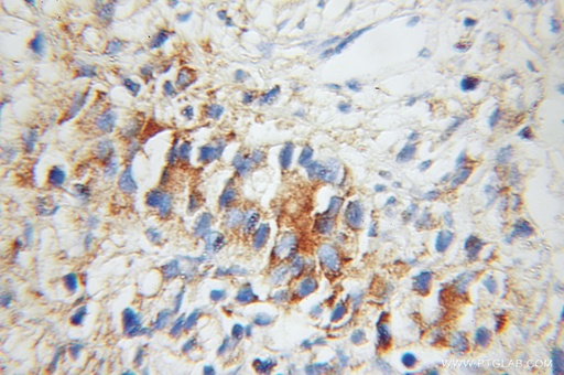 [11373-1-AP-150UL] UBE2D1/2/3/4 Polyclonal antibody