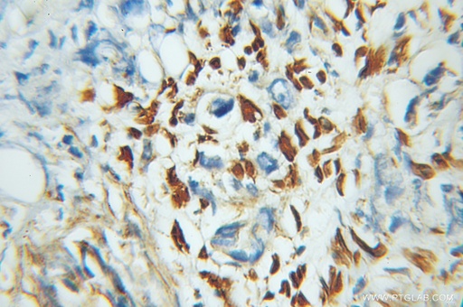 [11374-1-AP-20UL] ZNF266 Polyclonal antibody
