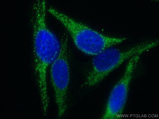 [11375-1-AP-20UL] FH Polyclonal antibody