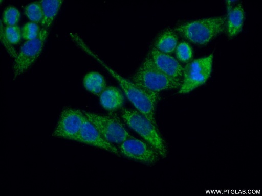 [11379-1-AP-150UL] ARHGEF5 Polyclonal antibody