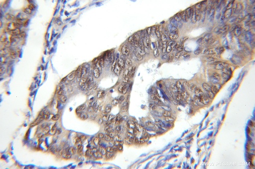 [11380-1-AP-20UL] DDB1 Polyclonal antibody