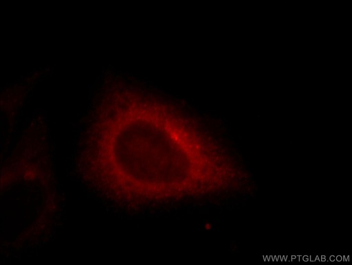 [11382-2-AP-150UL] EHD4 Polyclonal antibody