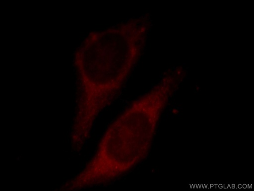 [11385-1-AP-20UL] ECH1 Polyclonal antibody
