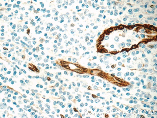 [11386-1-AP-20UL] ACKR2 Polyclonal antibody