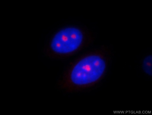 [11389-1-AP-20UL] PSMC4 Polyclonal antibody