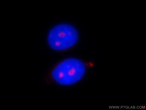 [11390-1-AP-20UL] PWP2 Polyclonal antibody