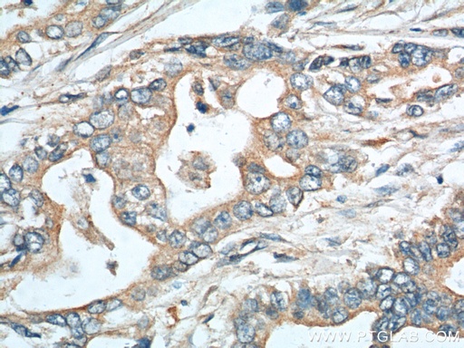 [11391-1-AP-20UL] EPCR Polyclonal antibody