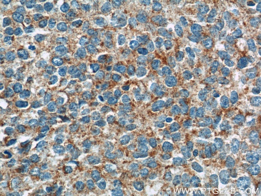 [11395-1-AP-20UL] GKAP1 Polyclonal antibody