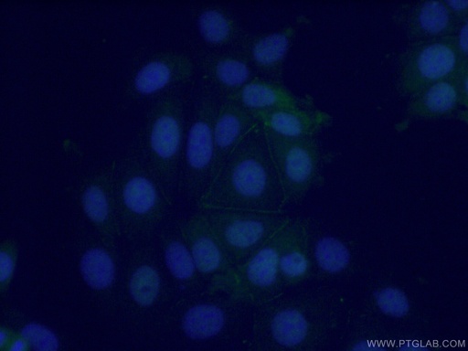 [11398-1-AP-20UL] POF1B Polyclonal antibody