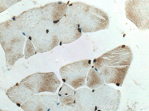 [11399-1-AP-150UL] NMNAT1 Polyclonal antibody
