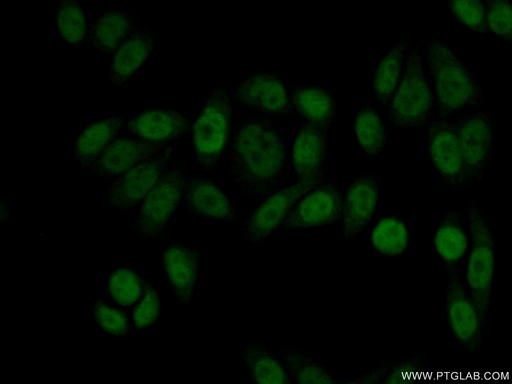 [11400-1-AP-20UL] ASRGL1 Polyclonal antibody
