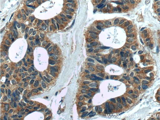 [11403-1-AP-150UL] MELK Polyclonal antibody