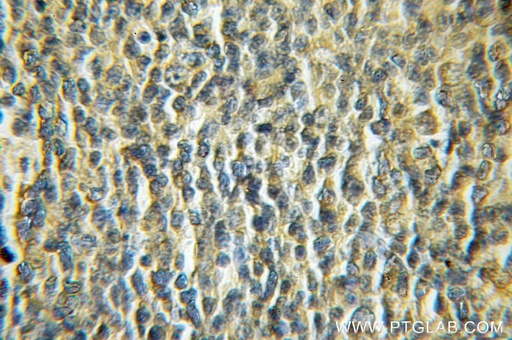 [11404-1-AP-150UL] NDOR1/NR1 Polyclonal antibody