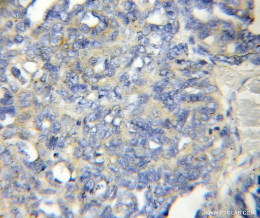 [11406-1-AP-20UL] LENG1 Polyclonal antibody