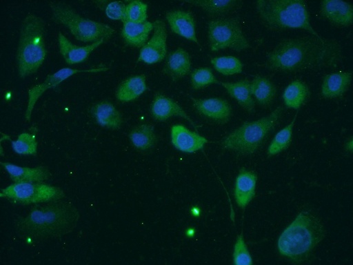 [11407-1-AP-150UL] TACC2 Polyclonal antibody