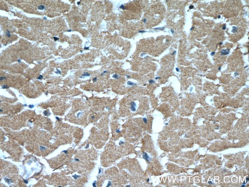 [11408-1-AP-20UL] XPO6 Polyclonal antibody