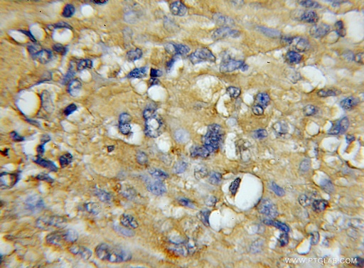 [11413-1-AP-20UL] COX7A1 Polyclonal antibody