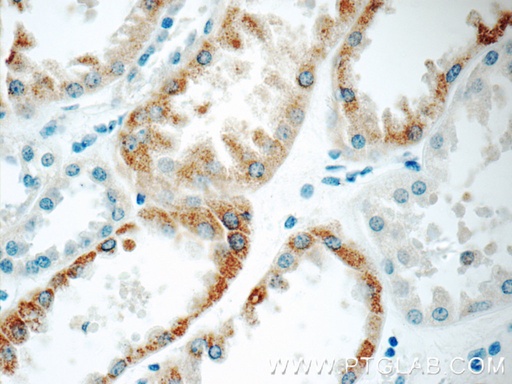 [11414-1-AP-20UL] C1QTNF3 Polyclonal antibody