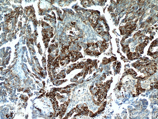 [11416-1-AP-150UL] COX7A2L Polyclonal antibody