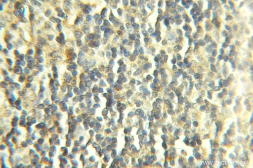[11417-2-AP-20UL] COX7B Polyclonal antibody
