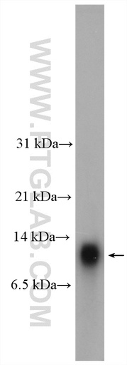 [11419-1-AP-150UL] HOPX Polyclonal antibody