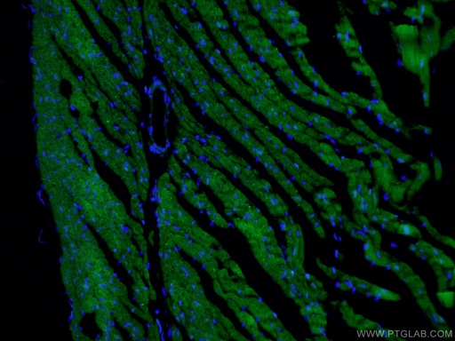 [11421-1-AP-150UL] COX6A2 Polyclonal antibody