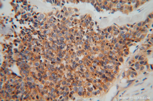 [11422-1-AP-150UL] MARCKSL1 Polyclonal antibody