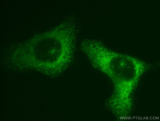 [11423-1-AP-150UL] EIF3M Polyclonal antibody