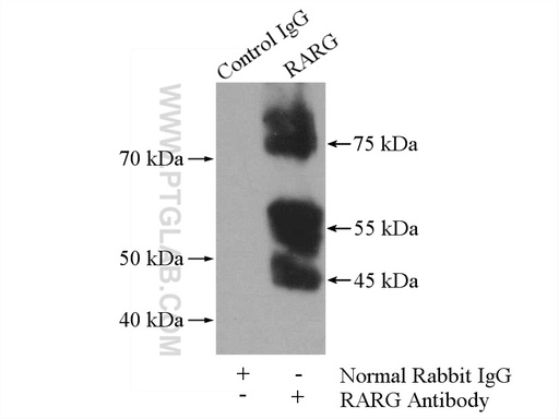 [11424-1-AP-150UL] RARG Polyclonal antibody