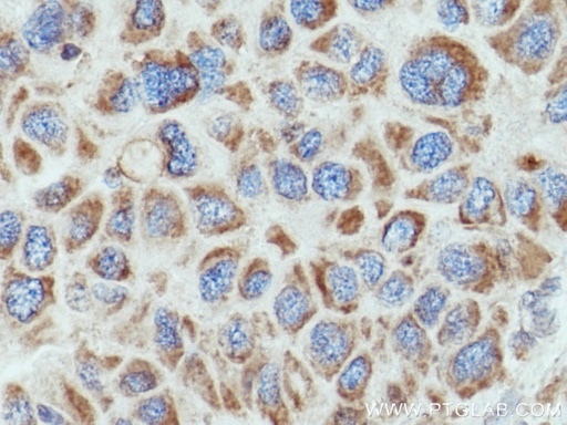 [11425-1-AP-150UL] COX6B1 Polyclonal antibody