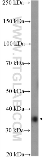 [11427-1-AP-20UL] ANKRD1 Polyclonal antibody