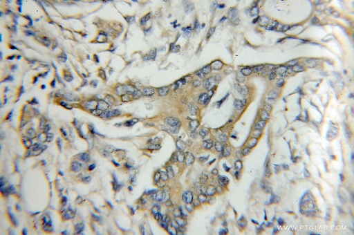 [11430-2-AP-20UL] Kallistatin Polyclonal antibody
