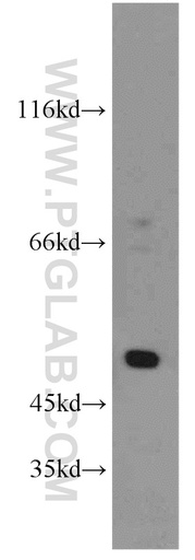[11431-2-AP-150UL] SESN3 Polyclonal antibody