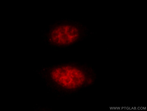 [11432-1-AP-150UL] HAT1 Polyclonal antibody