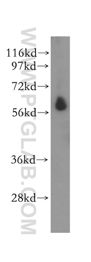 [11434-1-AP-150UL] STK32C Polyclonal antibody