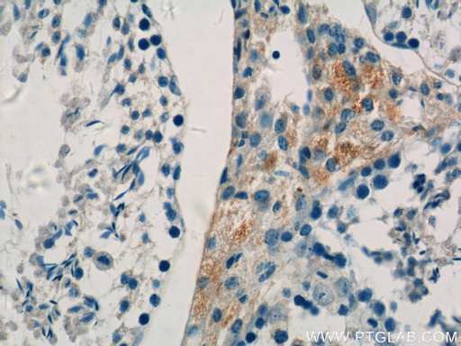 [11437-1-AP-150UL] COX6B2 Polyclonal antibody