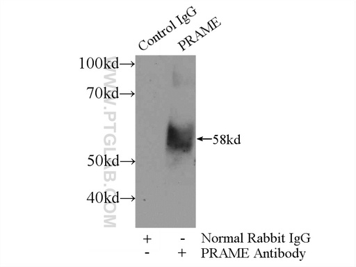 [11438-1-AP-150UL] PRAME Polyclonal antibody