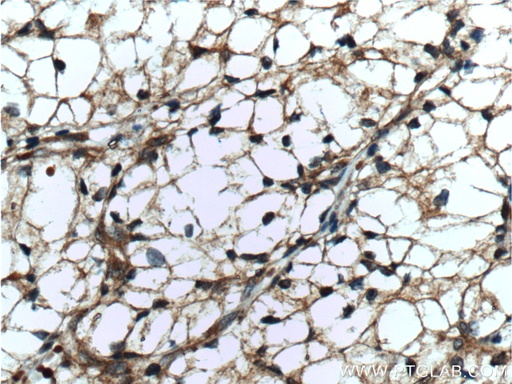 [11439-1-AP-20UL] GRK6 Polyclonal antibody