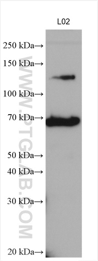 [11442-1-AP-150UL] PNPLA3 Polyclonal antibody