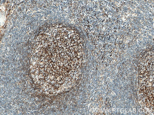 [11444-1-AP-20UL] VCAM-1 Polyclonal antibody