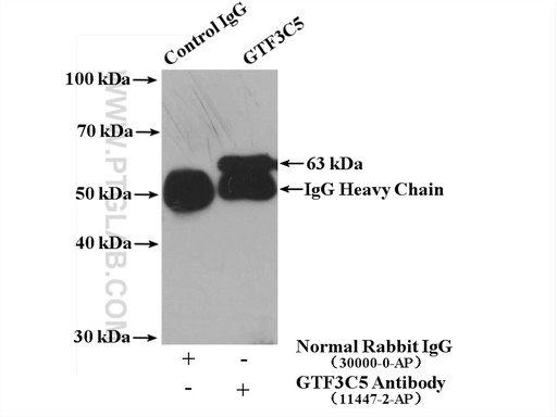 [11447-2-AP-150UL] GTF3C5 Polyclonal antibody