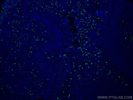 [11449-1-AP-20UL] Human IgA Heavy Chain Polyclonal antibody