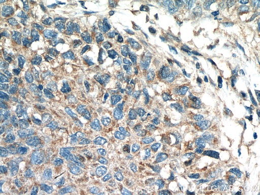 [11453-1-AP-20UL] Kindlin 2 Polyclonal antibody